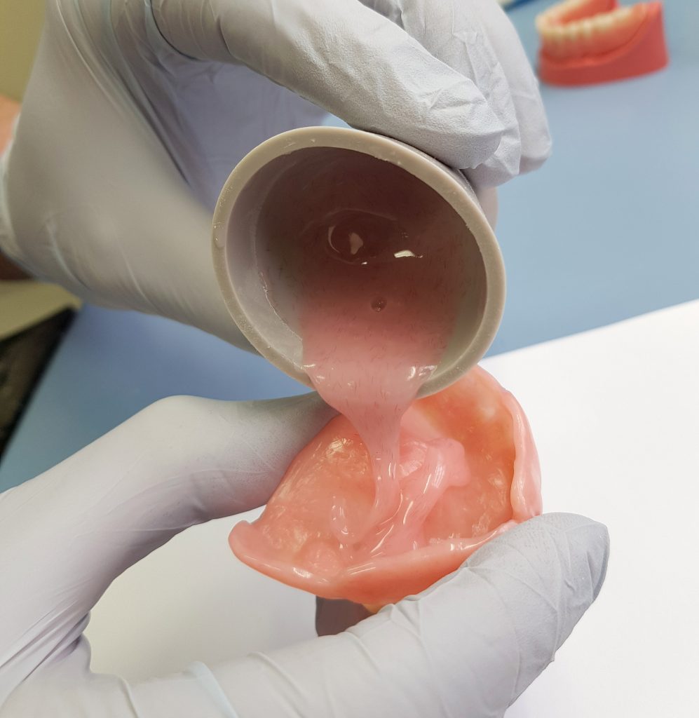 Denture Relines Wantirna & Boronia Same Day Relines